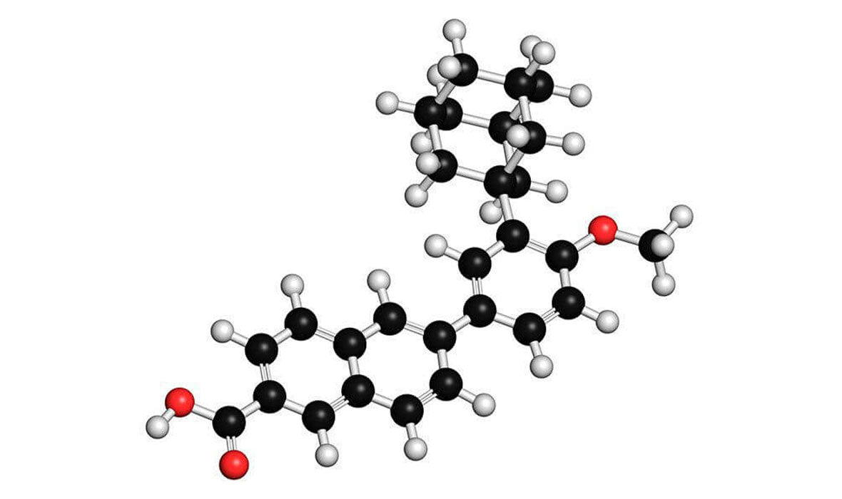 What is Retinization?