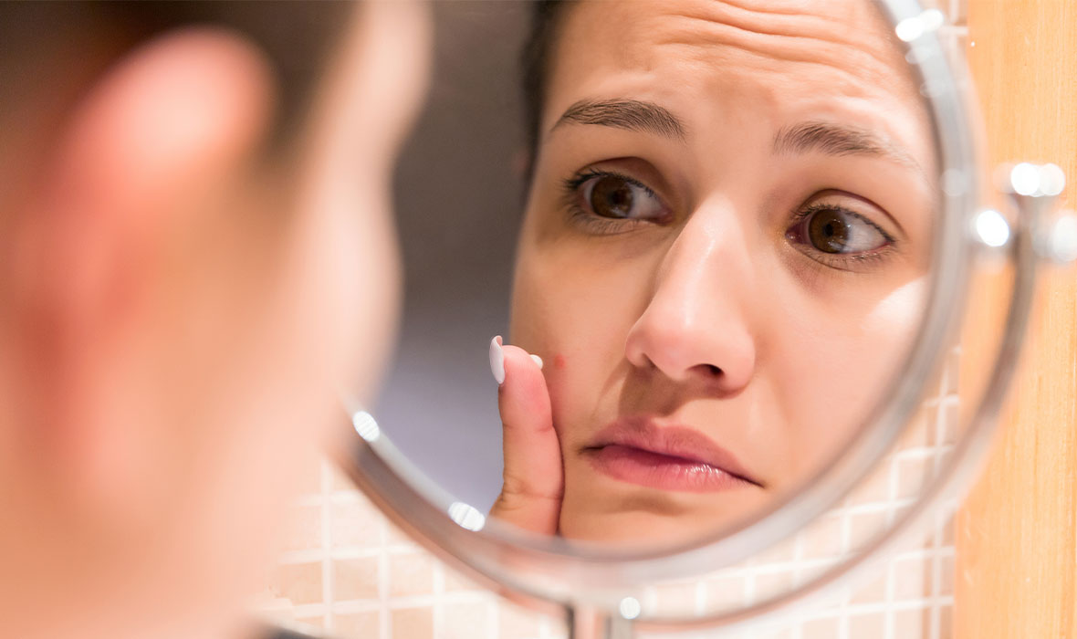How to stop getting acne in the same spot