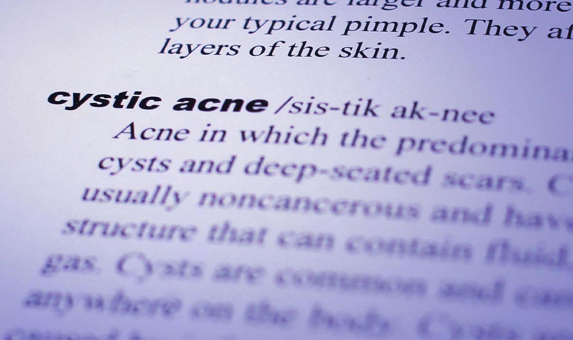 Nodular Acne and Cystic Acne