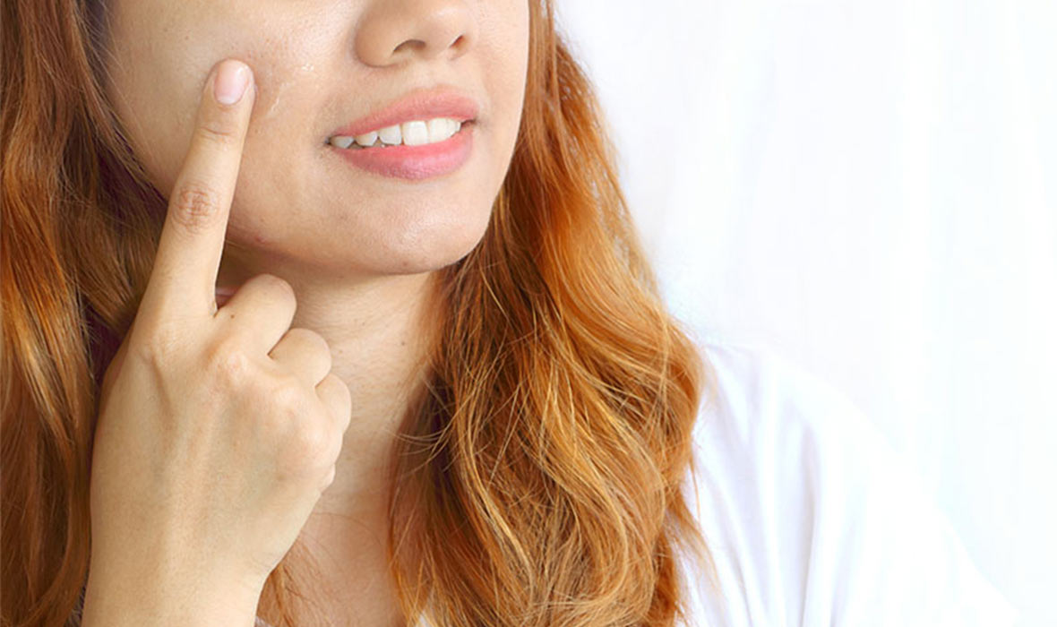 What Are Pores? 3 Things You Didn't Know