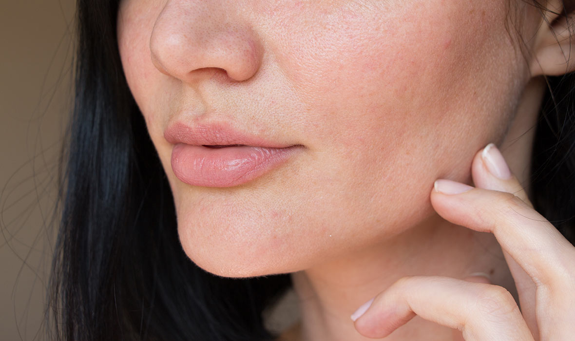 Top 4 Pore Myths Debunked
