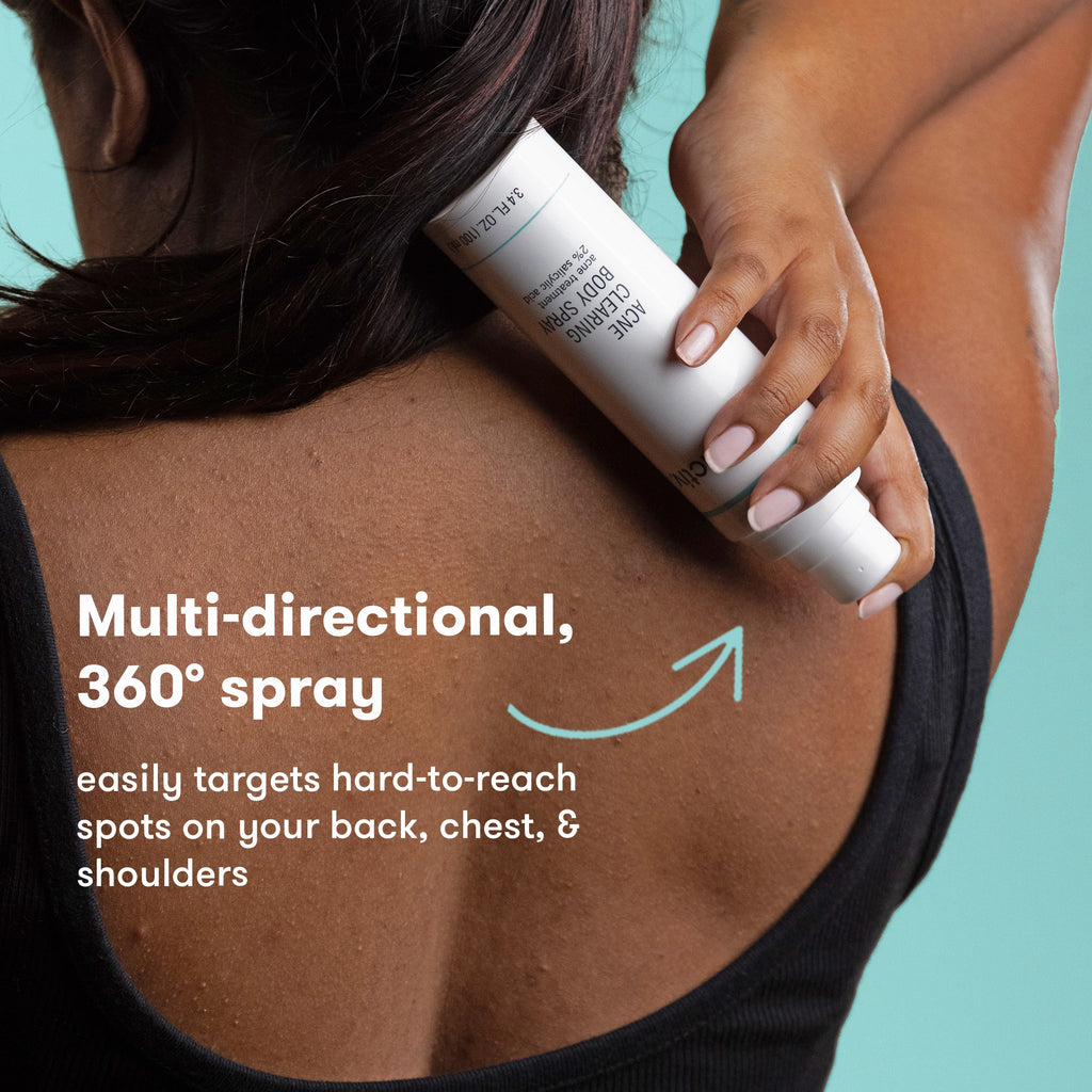 Acne Clearing Body Spray