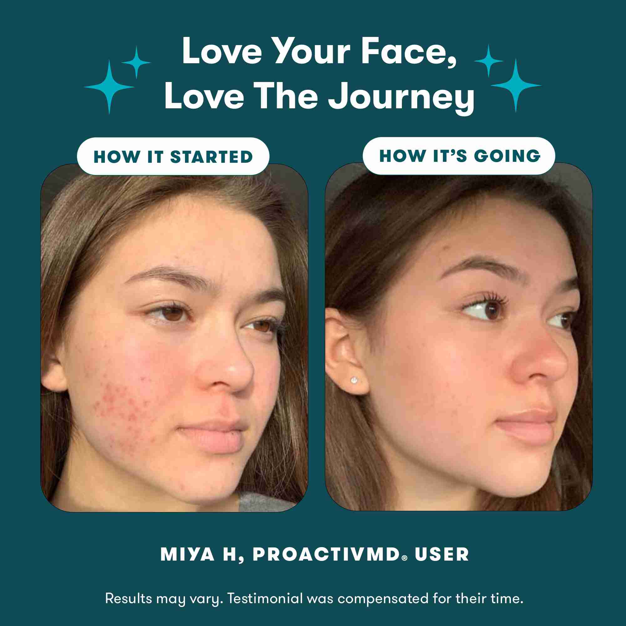 ProactivMD® 3-Step Acne Routine | Dermatologist-developed