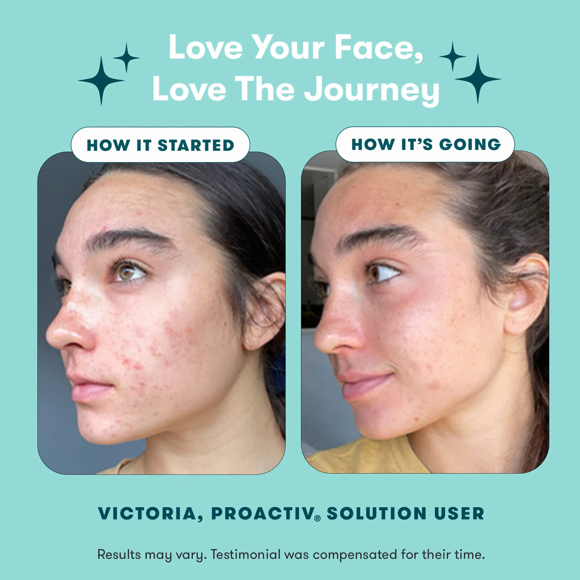 Proactiv Solution® 60-Day Back-to-School Bundle